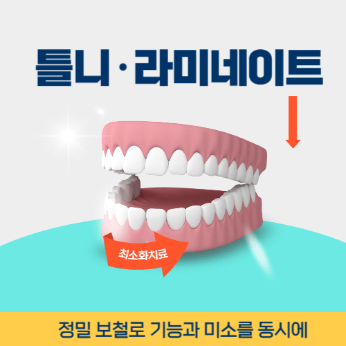 상주치과 상주시 치과 틀니 라미네이트