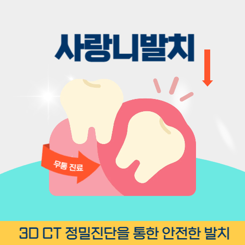 상주치과 상주시 치과 사랑니 발치